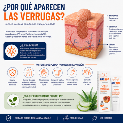 recupera tu confianza con Anti-Wart